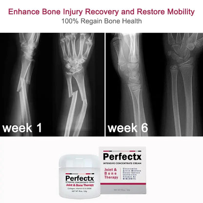 🔥 Hot Sale 50% OFF 🔥 Perfectx™ Joint & Bone Therapy Cream - Effective Bone Correction